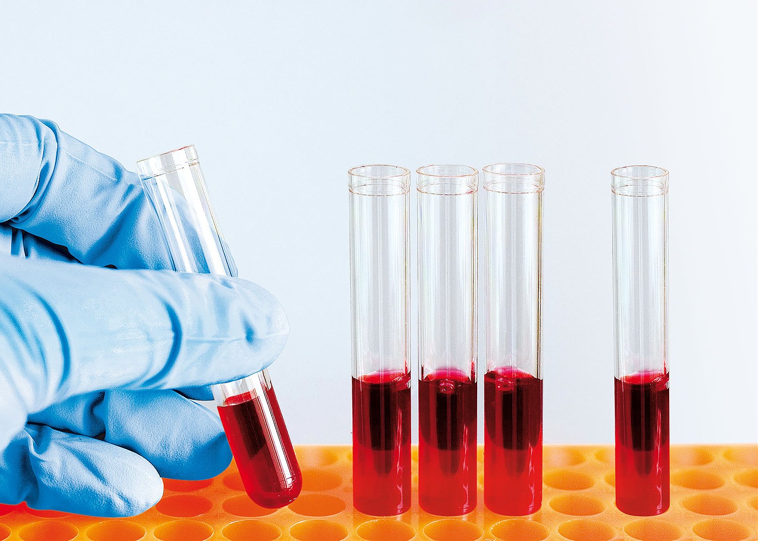 oncosachs pharma blutprobe